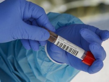 Оприлюднили статистику щодо коронавірусу в Україні за перший день лютого 