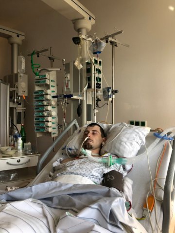 Волинянину, який важко травмувався на заробітках в Німеччині, стало гірше