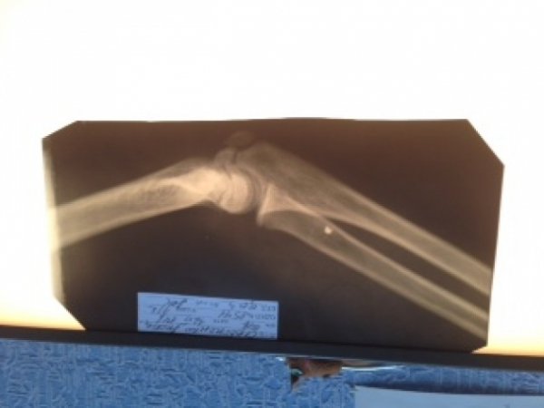 Підліток з Донеччини розповів, як в нього на очах розстріляли його родину