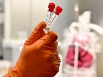 Ранок 17 липня: в Україні – 809 нових випадків коронавірусу, з них на Волині – 41