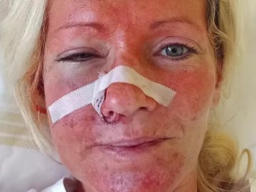 Затримали чоловіка, який побив у Чехії двох жінок, коли дізнався, що вони українки