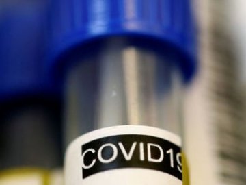 Повідомили статистику щодо коронавірусу в Україні за минулу добу