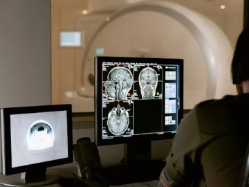 Роль томографії голови в діагностиці захворювань мозку