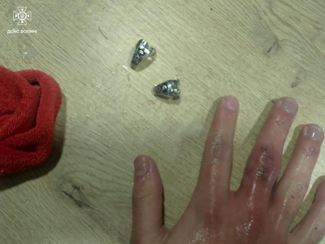 На Волині рятувальники допомогли зняти каблучку 17-річному хлопцю