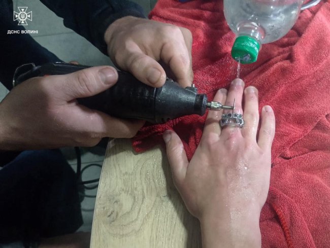 На Волині рятувальники допомогли зняти каблучку 17-річному хлопцю