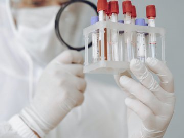 Де на Волині виявили нові випадки коронавірусу станом на 30 серпня 