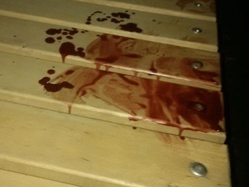 Неподалік «Версалю» - масова бійка з різаниною. Є постраждалі