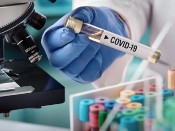 В українській армії за добу – 59 випадків коронавірусу