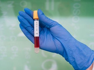 Оприлюднили статистику щодо коронавірусу в Україні за 3 січня