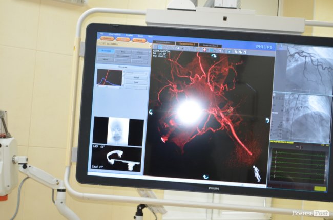 У Луцьку робитимуть унікальні операції на судинах. ФОТО