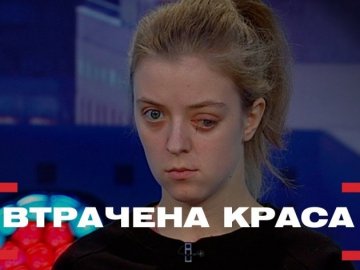 Хірург з Волині пообіцяв повернути красу дівчині, яка постраждала в аварії. ВІДЕО