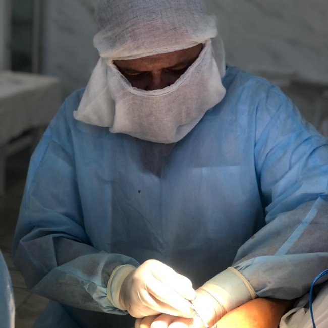 Гра у теніс закінчилася травмою: лікарі успішно прооперували руку волинянину