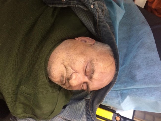 У Луцьку у «швидкій» помер чоловік: просять опізнати тіло. ФОТО 18+ 