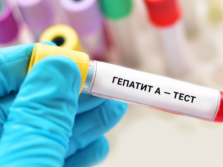 Спалах виник на одному з підприємств: у Луцькому районі зросла кількість хворих на гепатит А 