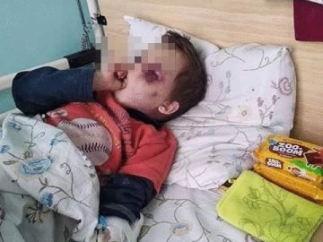 За синцями не видно очей: батьки познущались над 6-річним сином. ФОТО 18+