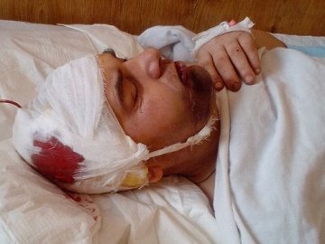 Побиття солдата у Володимирі: 23-річний офіцер Василь Арійчук каже, що не винний. ФОТО