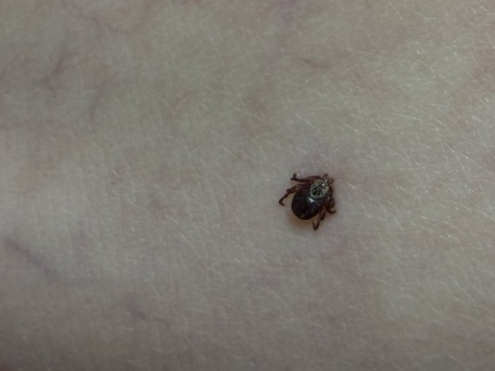 Укуси кліщів: скільки волинян звернулося до медичних закладів