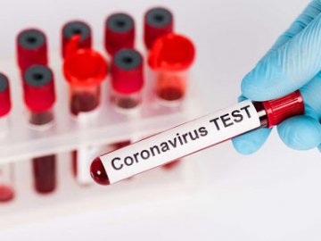 МОЗ рекомендує робити тест на Covid при будь-яких ознаках ГРВІ