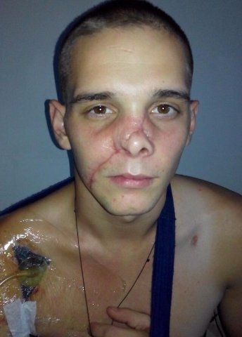 Волинський хірург безкоштовно прооперував десантника в Києві. ФОТО