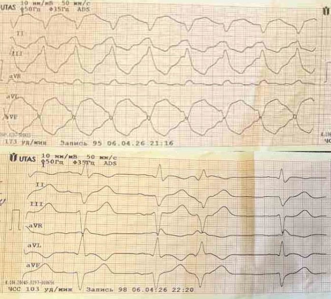 Як у кіно: лікарі швидкої на Волині врятували жінку завдяки електрокардіоверсії