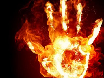 У пожежі під Луцьком жінка отримала опіки обличчя 