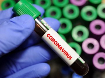 У Луцьку в далекобійника виявили коронавірус, 6 людей – із підозрою 
