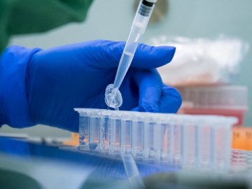 До кінця тижня запрацює ПЛР-лабораторія при волинській обласній лікарні