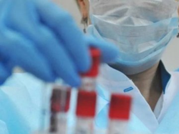 Ранок 19 липня: в Україні – 731 новий випадок коронавірусу, з них на Волині – 32