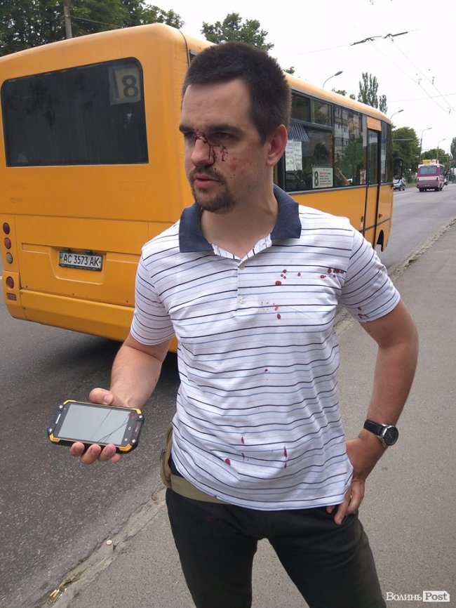 У Луцьку побили атовця, керівника осередку «НацКорпусу». ОНОВЛЕНО