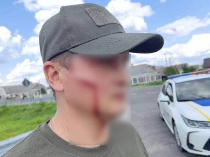 На Волині чоловік лопатою вдарив працівника ТЦК в обличчя