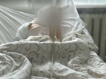 На Волині 5-річний хлопчик обгорів під час пожежі: розповіли деталі інциденту. ВІДЕО