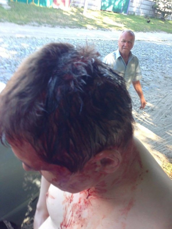 Невідомі напали на кандидата в народні депутати від комуністів Кононовича. ФОТО