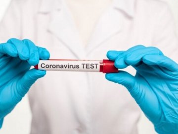 Хто в Україні може безкоштовно пройти тестування на COVID-19 
