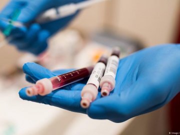 В Україні відкривають центри вакцинації людей з листа очікування в «Дії»