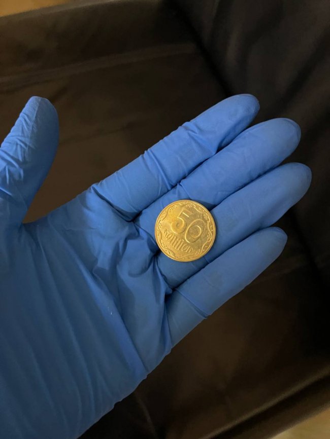 Батарейки, магніти і монети: волинські лікарі розповіли, що доводиться діставати зі стравоходів та дихальних шляхів дітей