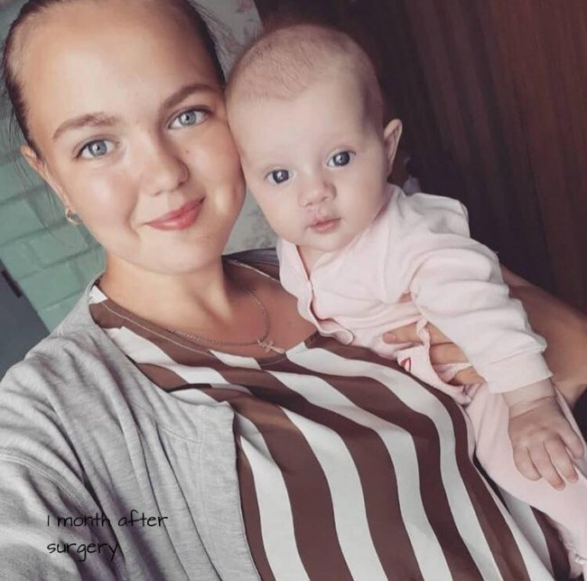 Хірург з Волині Валіхновський безкоштовно прооперував маленьку дівчинку