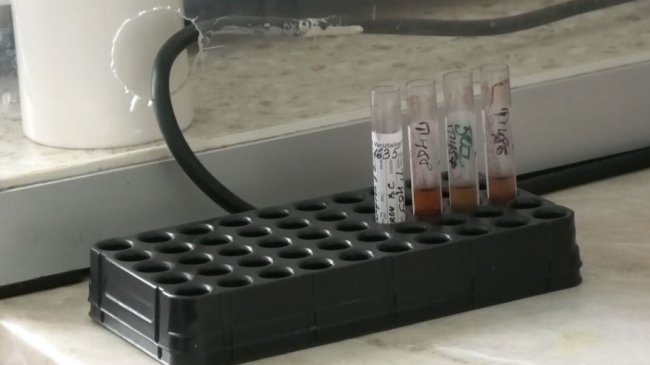 За 11 місяців ВІЛ/СНІД виявили у 130 волинян: як працює центр у Луцьку. ФОТО