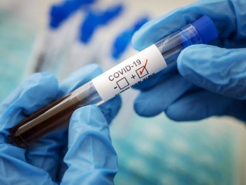Лікування COVID-19 у стаціонарі: яка безоплатна медична допомога доступна українцям