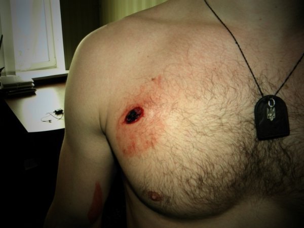 Фото поранених бійців Волинської сотні