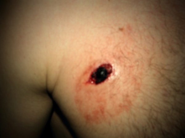 Фото поранених бійців Волинської сотні