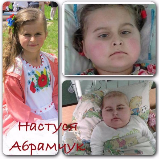 Благають про допомогу маленькій помираючій волинянці