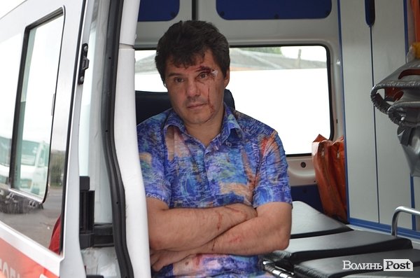 Під Луцьком – аварія за участю депутата облради. ФОТО. ВІДЕО