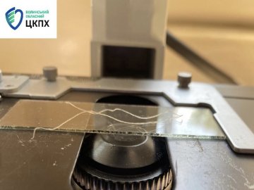 На Волині – новий випадок дирофіляріозу: з ока жінки витягнули 11-сантиметрового гельмінта