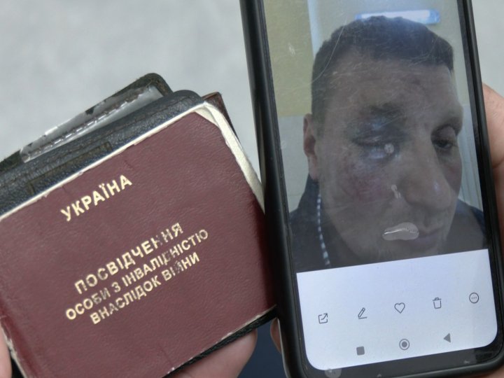 Поліція розслідує побиття ветерана у Луцьку: що відомо