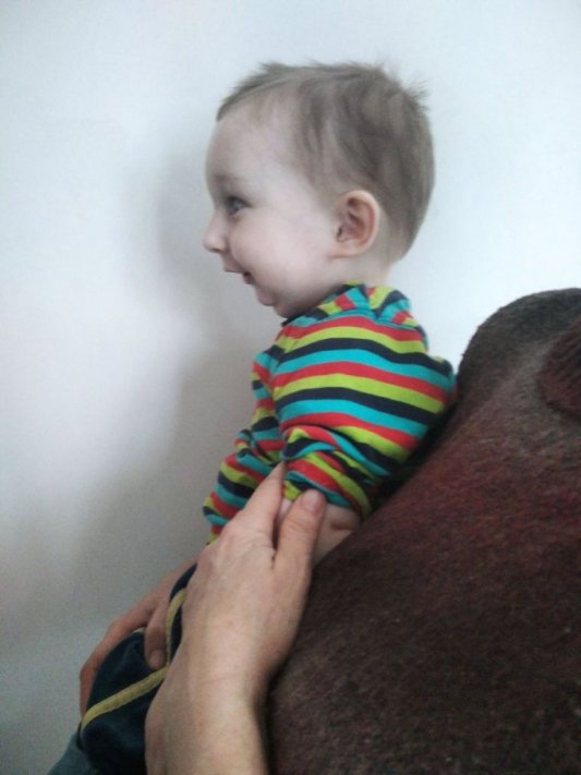 Залишилось зібрати ще 200 тисяч гривень: 2-річному хлопчику з Волині потрібні кошти на операцію