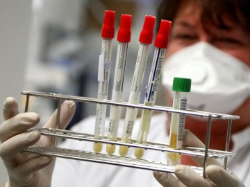 В Україні – 972 нових випадки коронавірусу, на Волині – 45