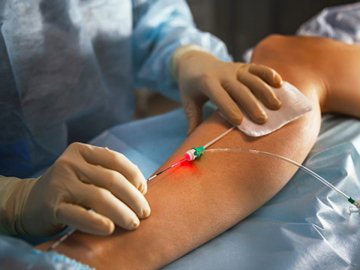 Волинський хірург розповів, чи потрібна операція при варикозі: які є варіанти