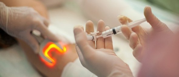 Варикоз. Лазерне лікування*