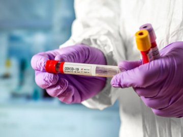 За минулу добу в Україні  підтвердили 8549 нових випадків COVID-19