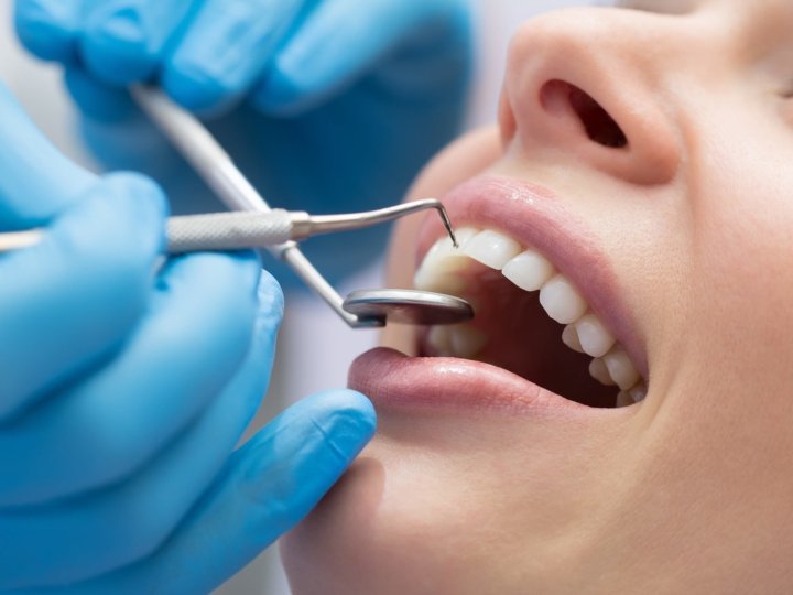 Ендодонтичне лікування: як рятують зуби від видалення